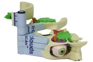 Medical model showing hinge and slice technology