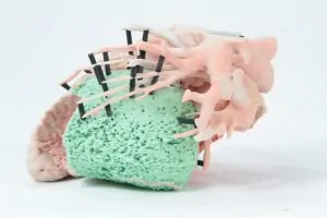 3D Printed Medical Heart Model